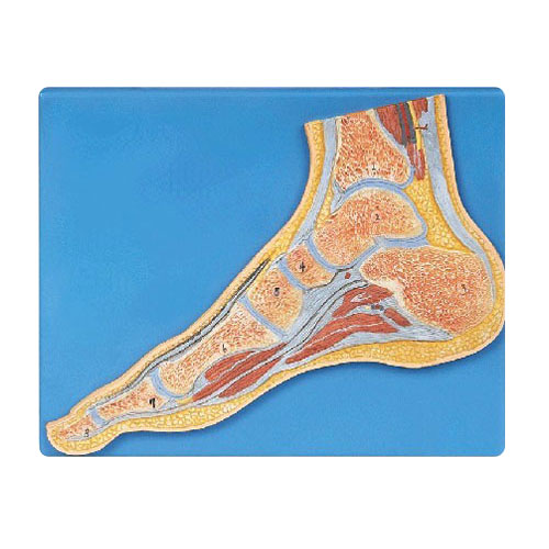 足關節剖面模型